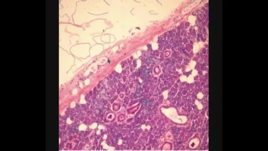 ПОДЧЕЛЮСТНАЯ ЖЕЛЕЗА. SUBMANDIBULAR GLAND. В световой микроскоп. Гистология.