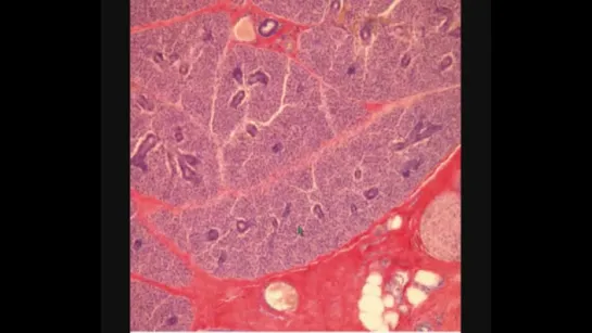 ОКОЛОУШНАЯ ЖЕЛЕЗА. PAROTID GLAND. В световой микроскоп. Гистология.