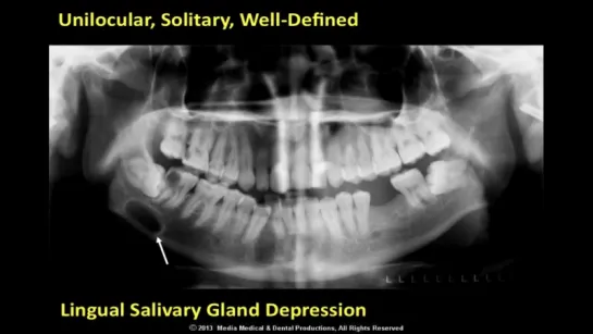 Radiographic Interpretation -The Differential Diagnosis- PL I - 4 of 8