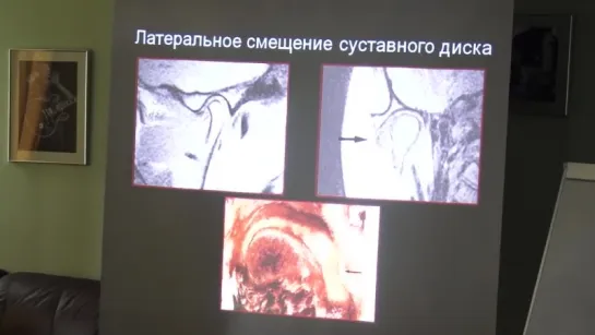 Конусно-лучевая компьютерная томография для стоматологов доступным языком. Алексей Локтионов.