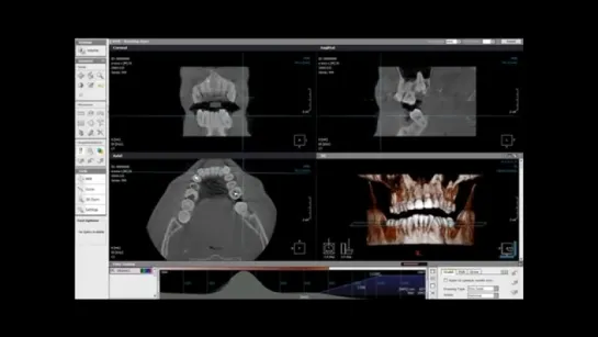 3D R- графия в стоматологии.wmv