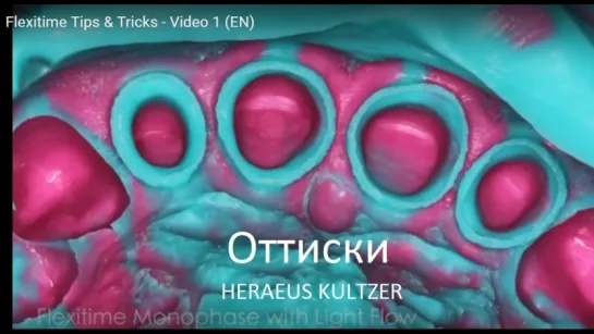 Flexitime Tips  Tricks - Video 1 (EN). HERAEUS KULTZER. Оттиски.