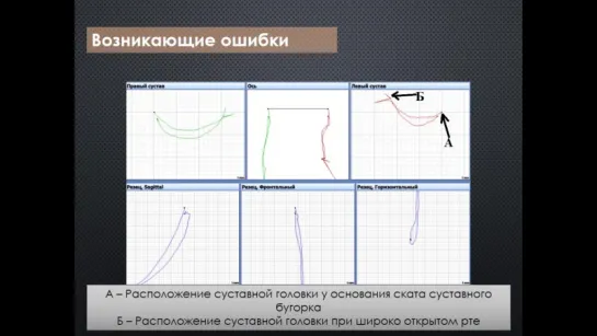 Регистрация артикуляции н-ч