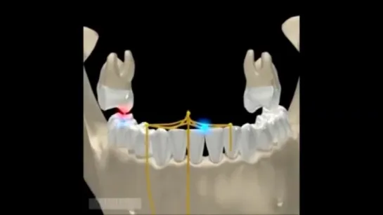 Mandibular Movements in 3D. Гнатология.