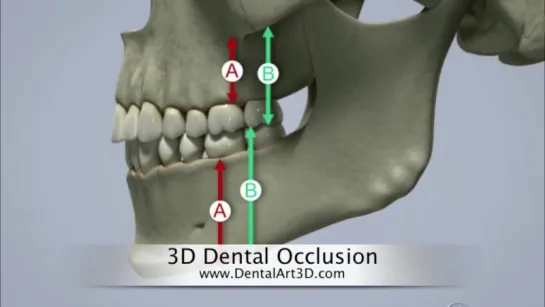 DentalArt3D. 3D Dental Occlusion. Гнатология.