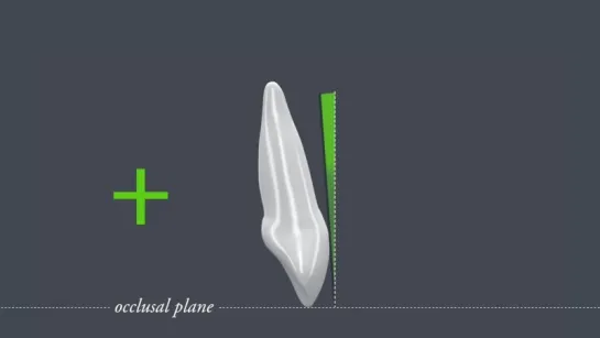 Ideal occlusion