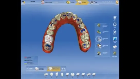 Sirona Виртуальный Артикулятор