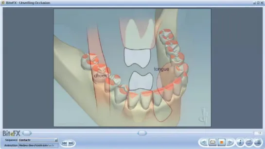 Dental Occlusion