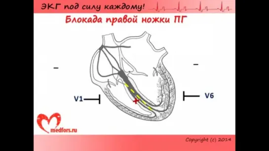 Школа ЭКГ. Урок 7