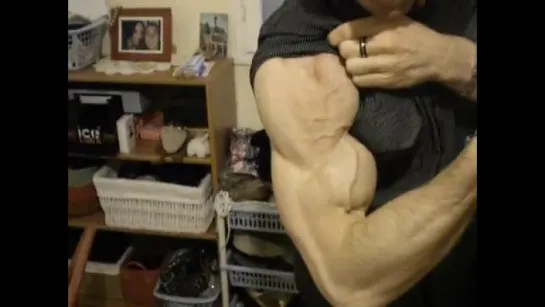 Vascular arm