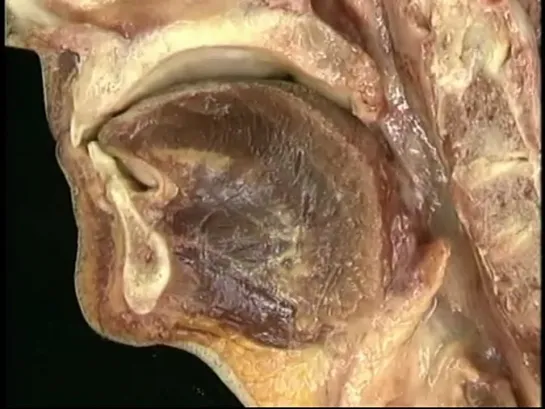 Видеоатлас анатомии Acland. Фильм 4, часть 4. Ротовая полость.
