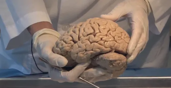 1. Introduction  Neuroanatomy Video Lab - Brain Dissections