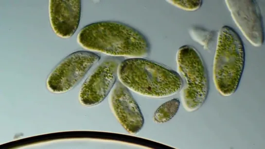 10. Paramecium bursaria