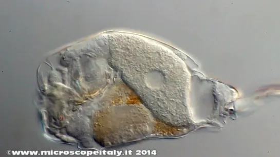 5. Cephalodella rotifer