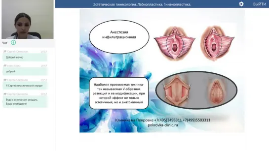 Эстетическая гинекология. Лабиопластика. Гименопластика