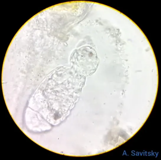 Вылупление коловратки Collotheca ornata из яйца. 1350х. Ускорено 4х.