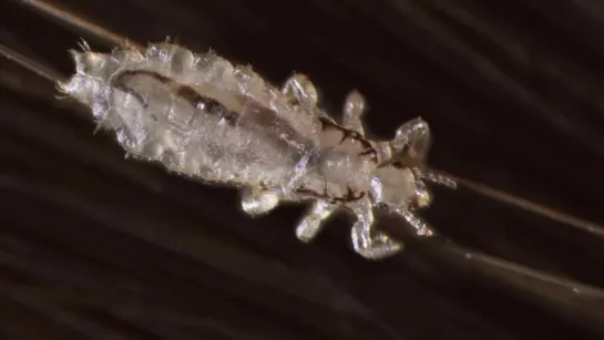 How Lice Turn Your Hair Into Their Jungle Gym (Deep Look)