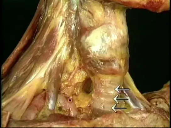 Видеоатлас анатомии Acland. Фильм 4, часть 5. Гортань.
