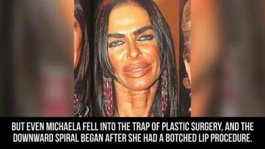 10 Plastic Surgery Cases That Went Too Far