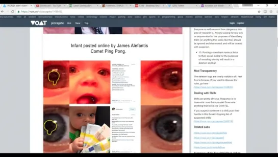 BREAKING - PIZZAGATE Investigation May Indicate RARE Eye Anomaly In Children Lin