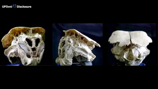 The Rhodope Skull_ Skull Was it a True ALIEN