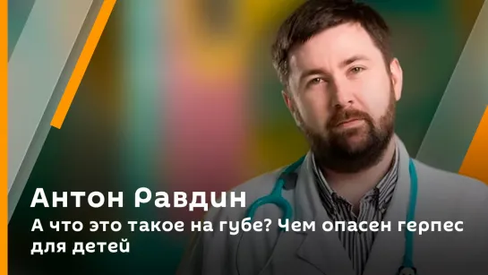 А что это такое на губе? Чем опасен герпес для детей | Антон Равдин