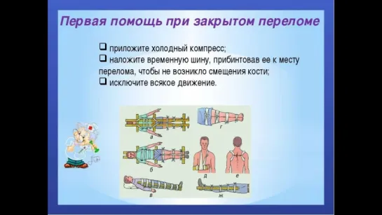 Первая помощь при закрытом переломе