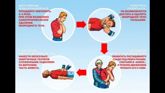 Неотложная помощь при асфиксии (подавился)