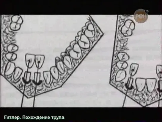 Секретные истории (РЕН-ТВ) - 1.Гитлер. Похождения трупа 2.Любимый предатель Гитлера: Рудольф Гесс 3.Кто вы, Мартин Борман?