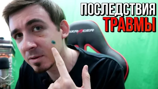 TheGideonGames ХРУСТ КОСТЕЙ  Последствия травмы