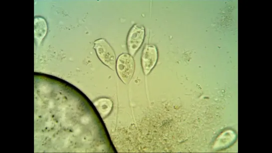 Инфузории сувойки (Vorticella).