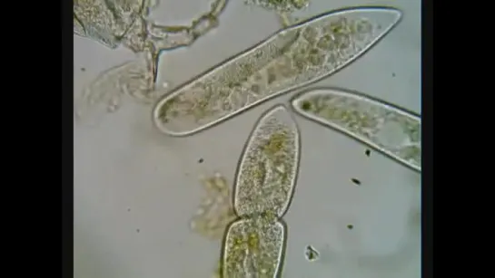 Paramecium Dividing - деление туфелек