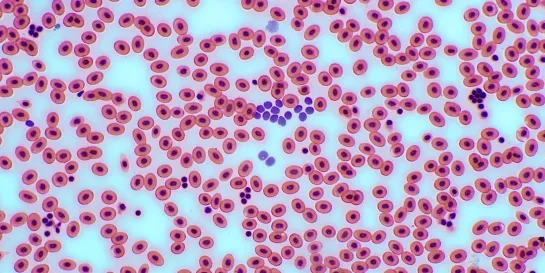 Кровь после вакцинации под микроскопом