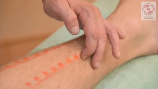 Точечный массаж (акупрессура) нижних конечностей. Spot massage (acupressure) of the leg