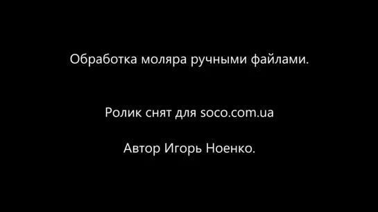 Работа ручными эндодонтическими файлами