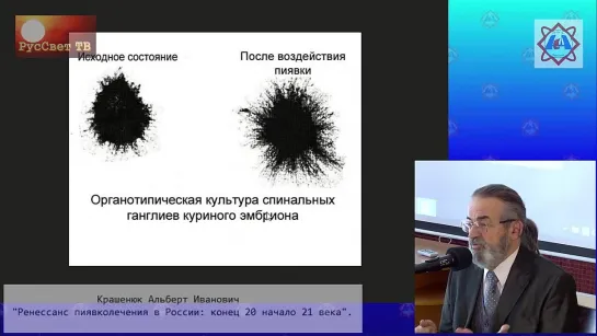 Крашенюк Альберт Иванович Ренессанс пиявколечения в России_ конец XX - начало XX