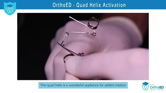 Quad Helix Activation. Ортодонтия.