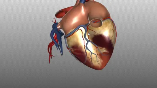 28. Blood supply to the heart - PART 1 - Anatomy Tutorial