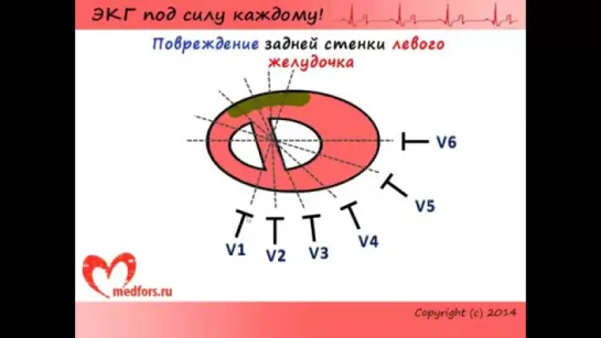 Урок 10. Видеокурс ЭКГ под силу каждому КНИГА