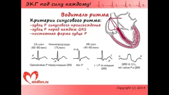 Урок 3. Видеокурс ЭКГ под силу каждому