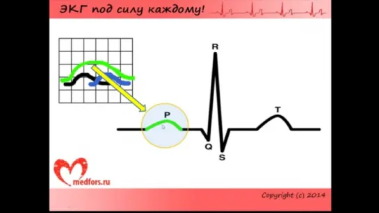 Урок 2. Видеокурс ЭКГ под силу каждому