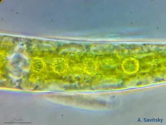 Одноклеточная зеленая водоросль Closterium.