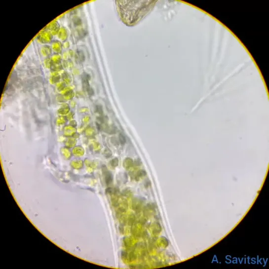 Инфузория Thuricola folliculata. 1350х