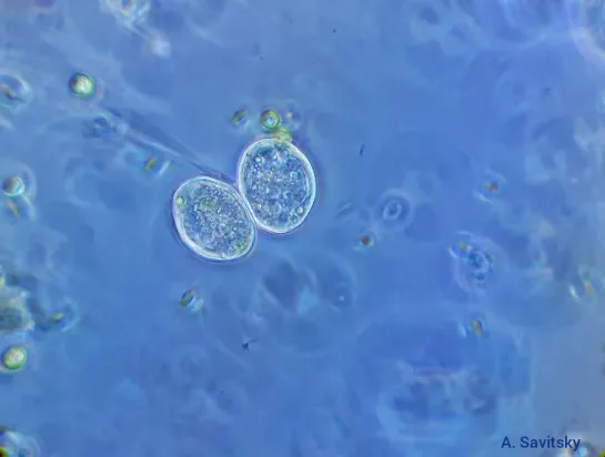 Деление инфузории Сувойки (Vorticella). 1000х