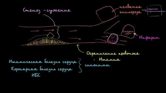 Стеноз, ишемия и сердечная недостаточность