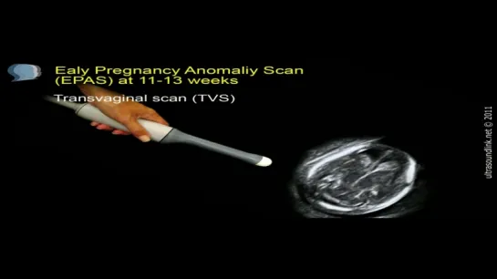 The 12 week scan_ transabdominal and transvaginal ultrasound