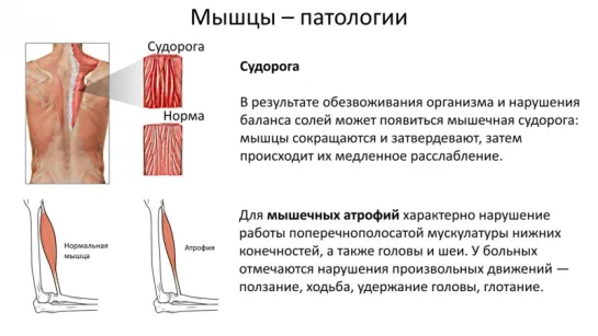 9.1 Анатомия и физиология-Опорно двигательная система заболевания