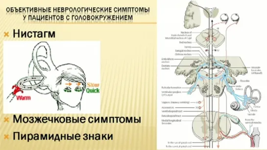 Головокружение. Часть 2