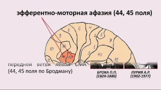 12. Эфферентно-моторная афазия. Теоретическая часть