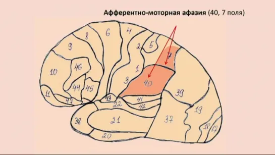 10. Афферентно-моторная афазия. Теоретическая часть